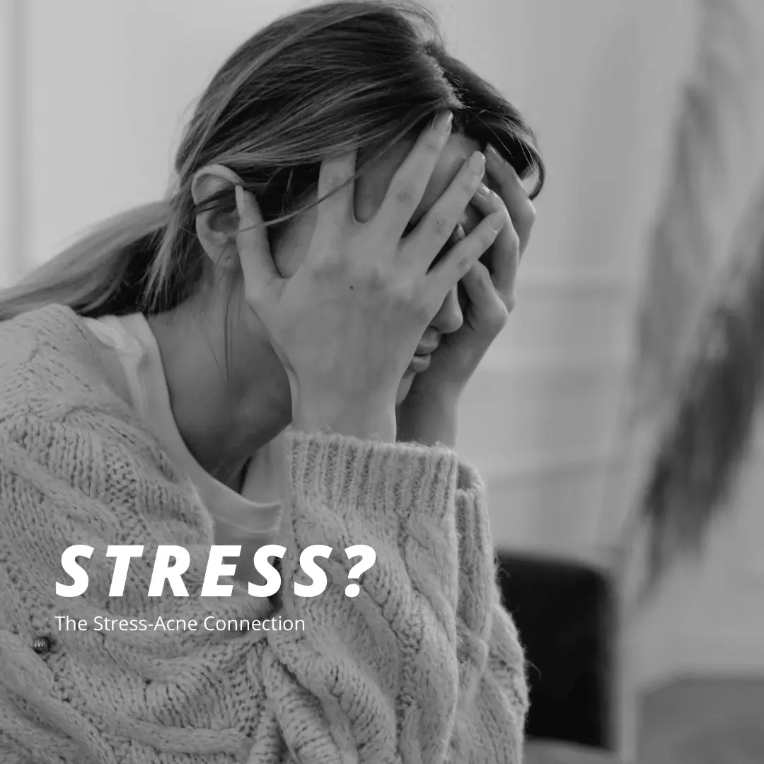 Stress Acne Connection | Facial Studio Magdalena in Chicago IL