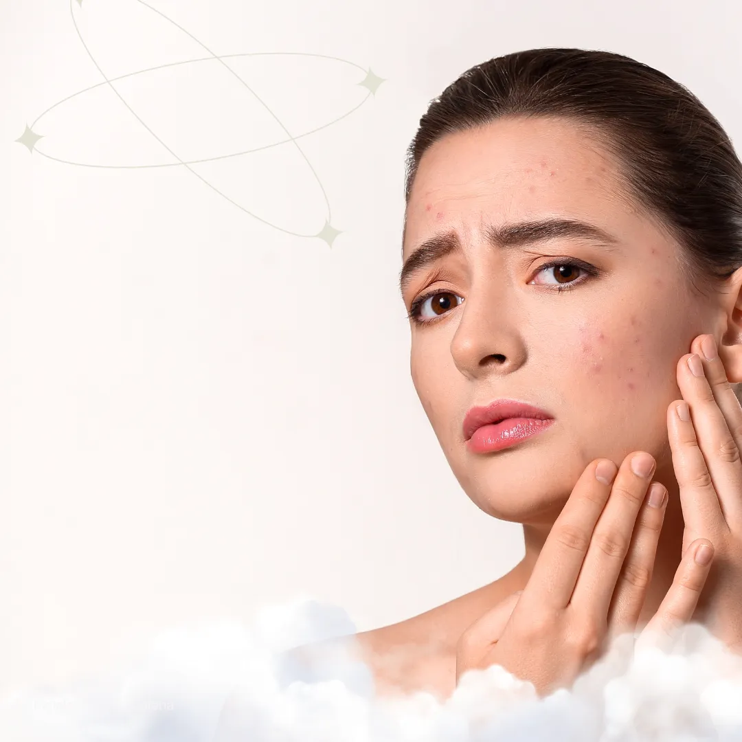 Adult Acne Treatment Chicago | Facial Studio Magdalena