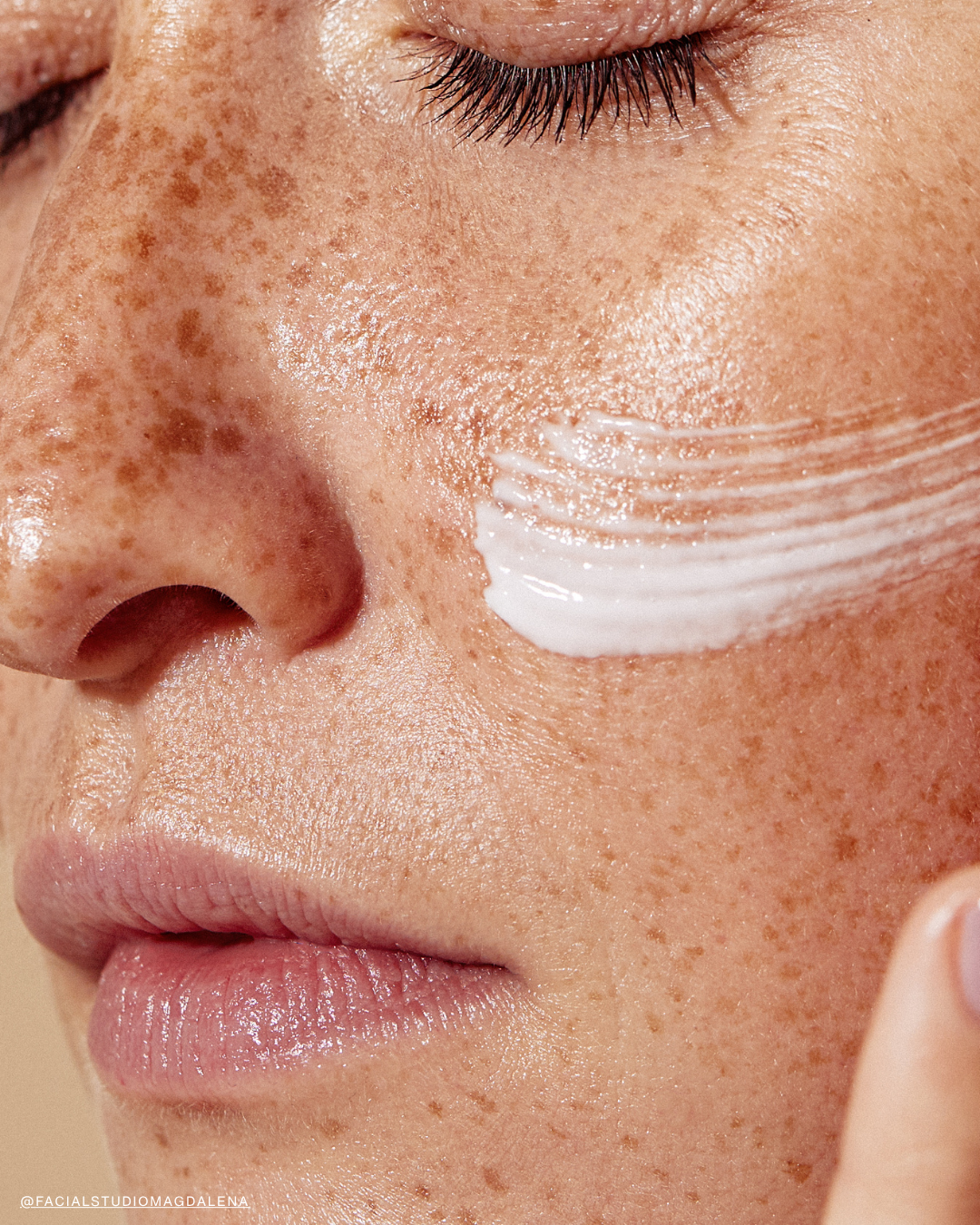 Chemical peel treatment at Facial Studio Magdalena in River North Chicago