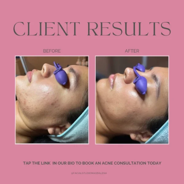 Client Results | Facial Studio Magdalena in Chicago IL